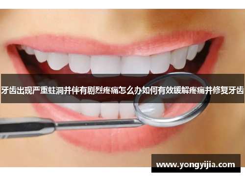 牙齿出现严重蛀洞并伴有剧烈疼痛怎么办如何有效缓解疼痛并修复牙齿